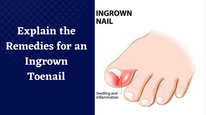 ingrown-toenail-treatment