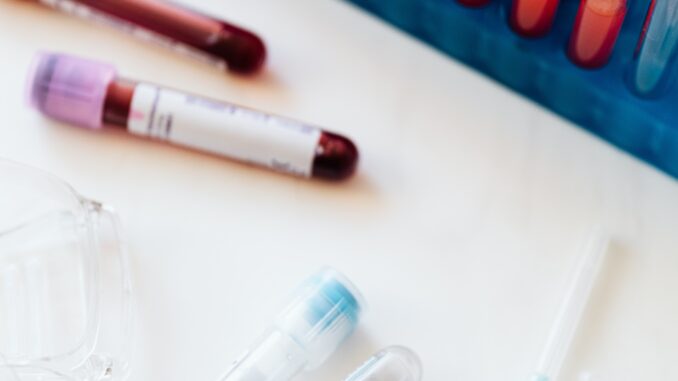 blood-collection-tubes-red-gold-green-lavender-white-blue-gray