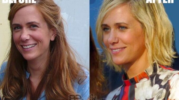 kristen-wiig-plastic-surgery