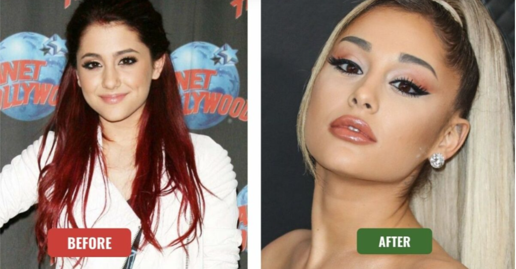 ariana-grande-before-and-after-plastic-surgery