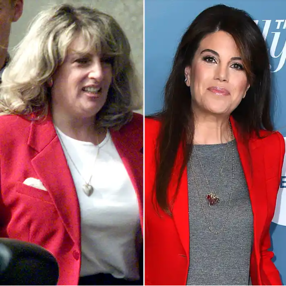 Linda Tripp Plastic Surgery 2023