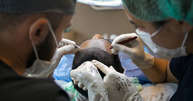 scalp-micropigmentation-procedure