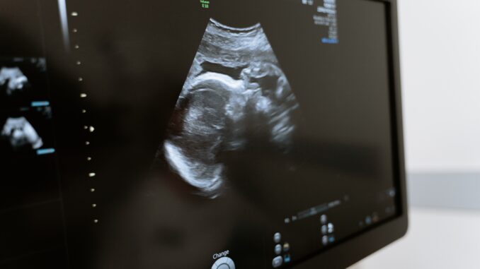 ultrasound-doctor-near-me