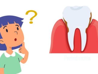 how-fast-does-periodontitis-progress