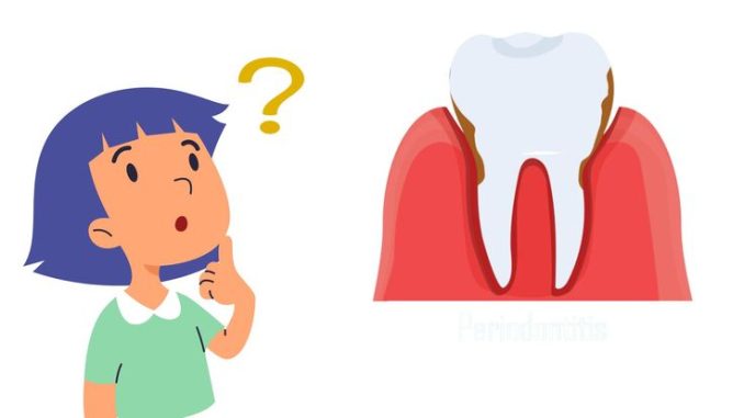 how-fast-does-periodontitis-progress