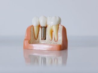 dental-implant-clinic-near-me